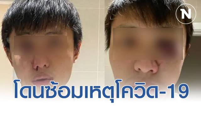 นศ.สิงคโปร์ ถูกวัยรุ่นอังกฤษเหยียดจากโควิด-19 ก่อนถูกซ้อม - ครูโอ๋ รูปที่ 0