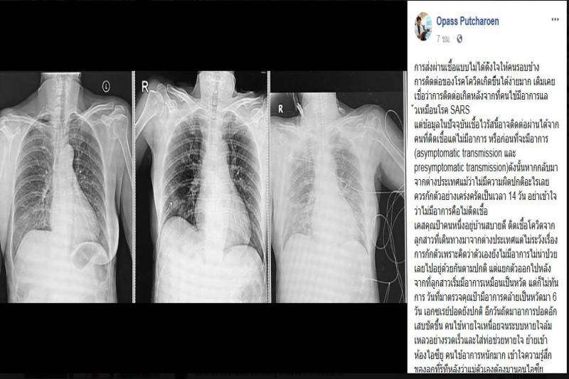 ลูกกลับจากเมืองนอกไม่กักตัว แพร่โควิดติดแม่จนโคม่า - ครูโอ๋ รูปที่ 0